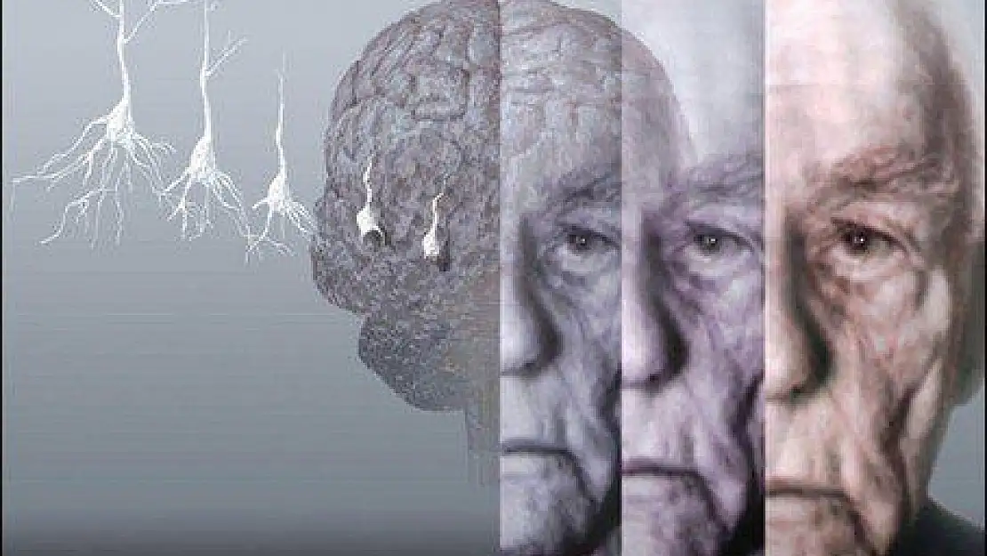 Dünya Alzheimer Günü