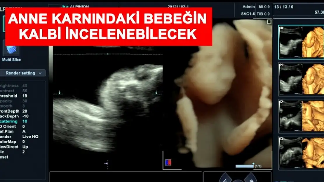 Hizmet Başladı