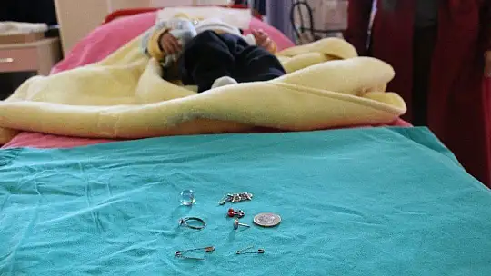 5 aylık bebeğin yuttuğu çengelli iğne operasyonla çıkarıldı