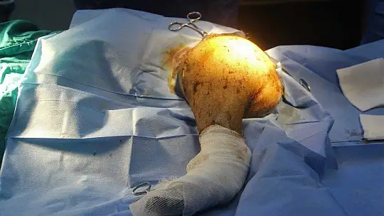 Araç çarpması sonucu bacakları kırılan yavru ayı ameliyata alındı