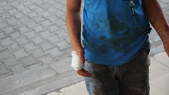 Babasına kurban kesmek için yardım eden çocuk elini kesti