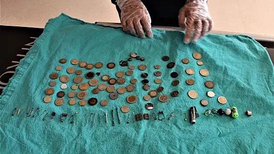 Çocukların midesinden çıkan onlarca yabancı cisim şaşırttı
