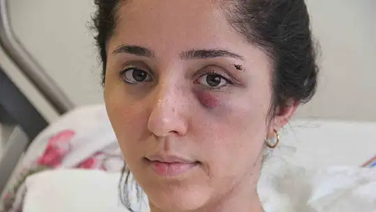 Darp edilip bıçaklanmıştı, kendisini öldürmeye çalışan doktor sevgilisinden şikayetçi olmadı