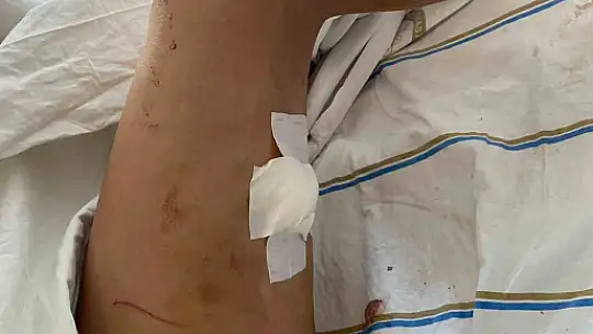 Darp edilip bıçaklanmıştı, kendisini öldürmeye çalışan doktor sevgilisinden şikayetçi olmadı