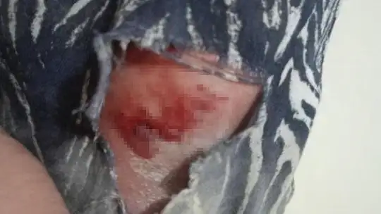 Elazığ'da başıboş köpeklerin kovaladığı şahıs yaralandı