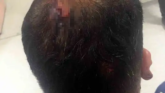 Elazığ'da bir seçim kavgası daha: 4 yaralı
