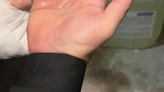 Elazığ'da parmağa sıkışan yüzüğü itfaiye ekipleri çıkardı