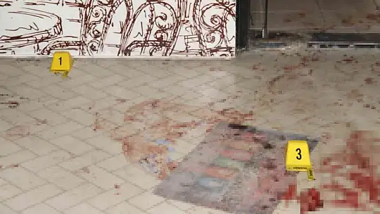 Elazığ'da silahlı kavga: 1 yaralı