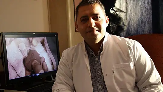 Epilepsi pili operasyonu sara hastalarının umudu oldu, 60 ilden başvuru geldi
