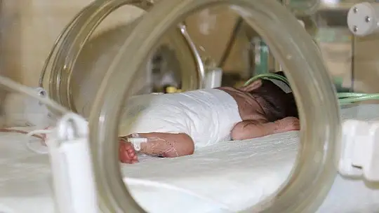 Prematüre bebeklere 'anne şefkati' ile bakıyorlar