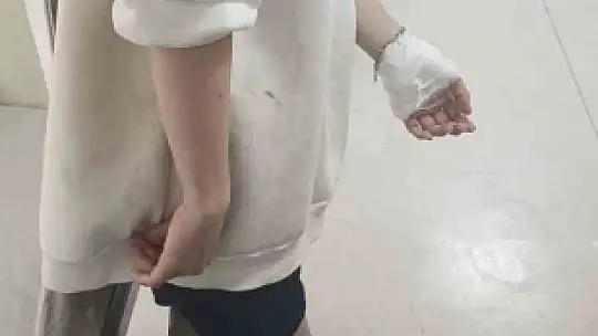 Sokak köpeklerinin saldırısına uğrayan 17 yaşındaki kız yaralandı