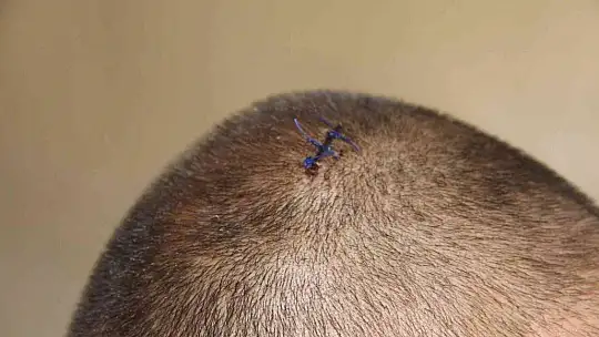 Tıraş makinesi yere düştü, bir ailenin huzuru yok oldu