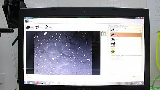 Türkiye'de sperm numunelerini 3 farklı kategoride analiz eden sistem geliştirdi